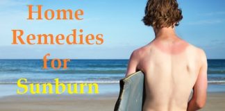 Home remedies for sunburn