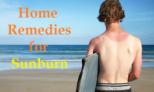 Home remedies for sunburn