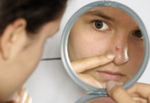 How to get rid of a pimple overnight