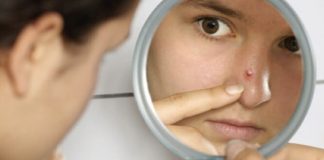 How to get rid of a pimple overnight