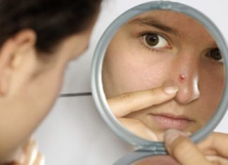 How to get rid of a pimple overnight