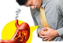 How to get rid of acid reflux