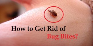 how to get rid of bug bites