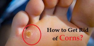 how to get rid of corns