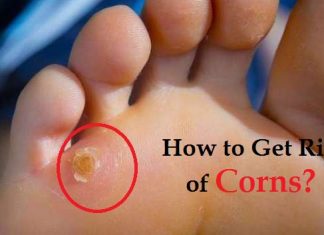 how to get rid of corns