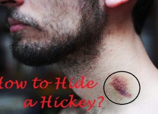 how to hide a hickey