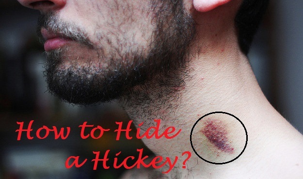 how to hide a hickey