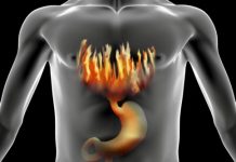 home remedies for heartburn