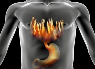 home remedies for heartburn