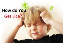 how do you get lice