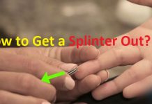 how to get a splinter out