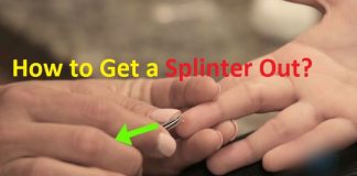 how to get a splinter out