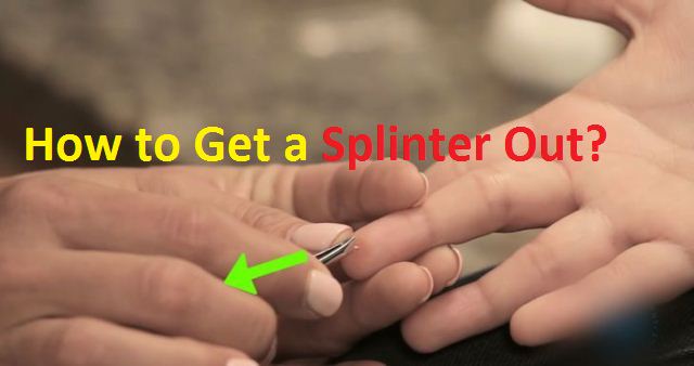 how to get a splinter out