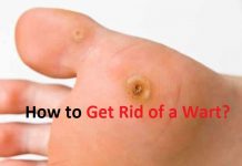 how to get rid of a wart