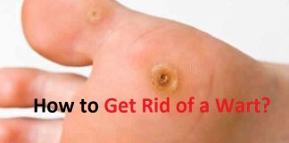 how to get rid of a wart