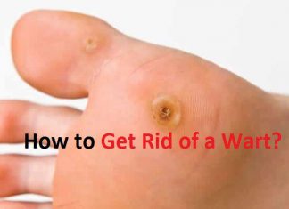 how to get rid of a wart