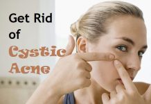 how to get rid of cystic acne