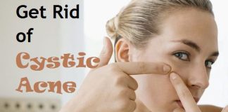 how to get rid of cystic acne