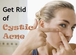 how to get rid of cystic acne