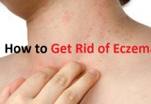 how to get rid of eczema