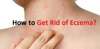 how to get rid of eczema