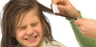 how to get rid of head lice