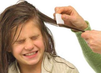 how to get rid of head lice