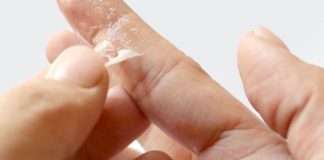 how to get super glue off skin