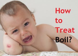 how to treat a boil