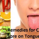 remedies-for-canker-sore-on-tongue