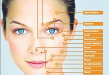 acne face map