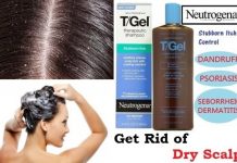 Best shampoo for dry scalp