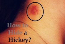 How to hide a hickey