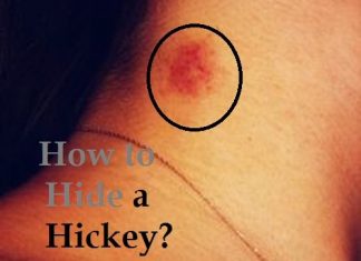 How to hide a hickey