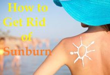 how to get rid of a sunburn