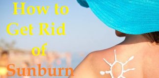 how to get rid of a sunburn