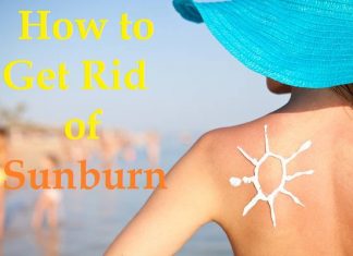 how to get rid of a sunburn