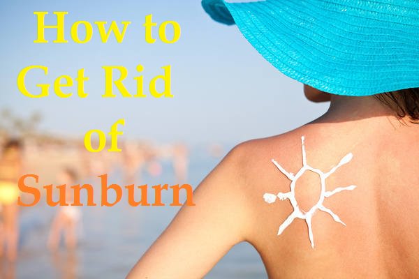 how to get rid of a sunburn