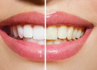 how to whiten teeth fast at home