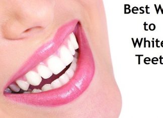 best way to whiten teeth