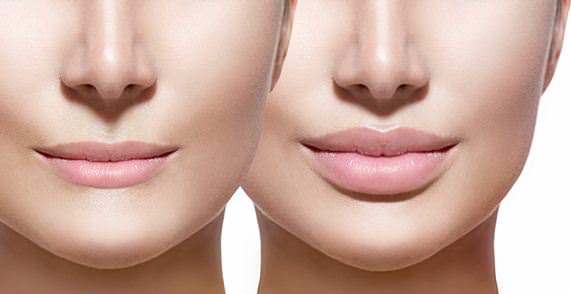 how to get bigger lips