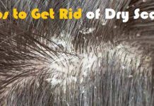 how to get rid of dry scalp