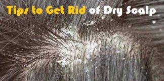 how to get rid of dry scalp