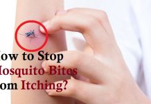 how to stop mosquito bites from itching