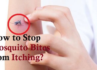 how to stop mosquito bites from itching