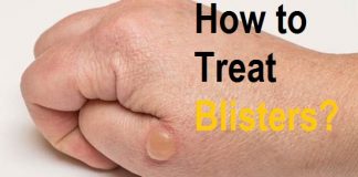 how to treat blisters