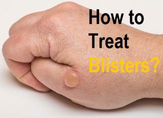 how to treat blisters